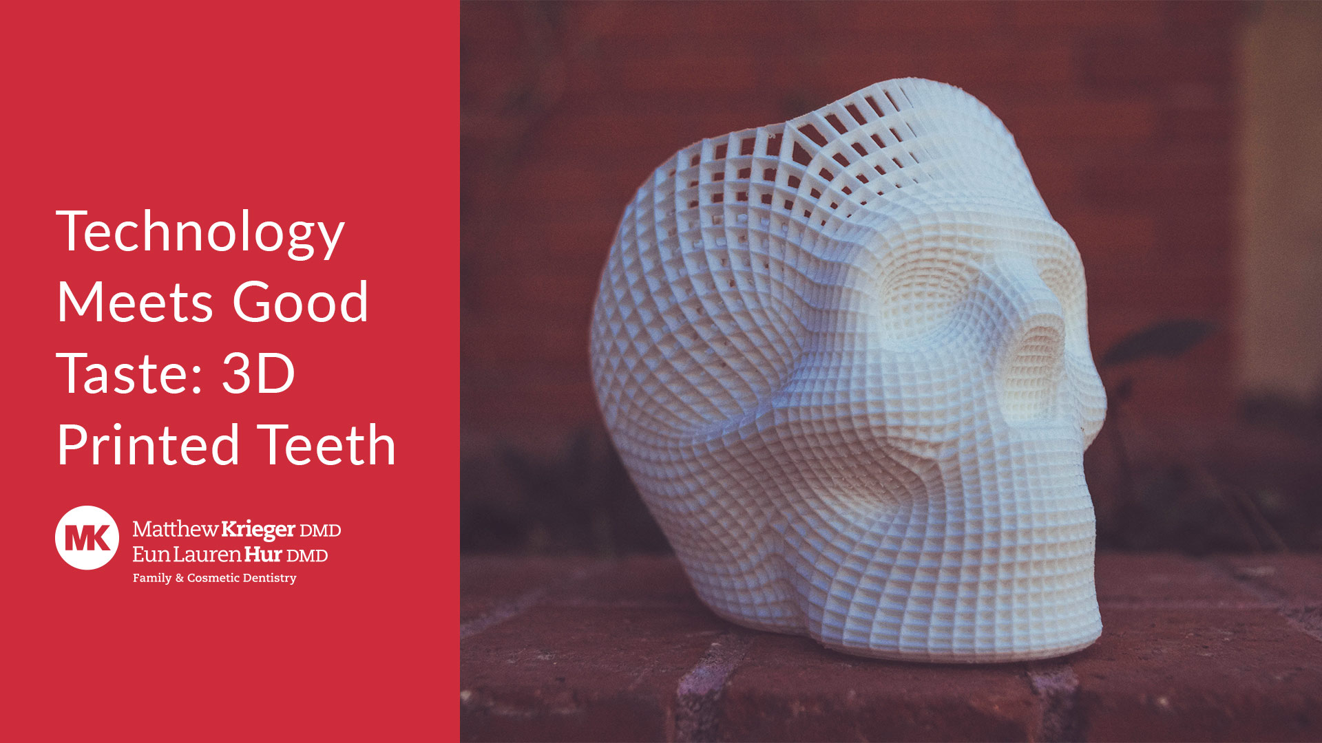 Technology Meets Good Taste: 3D Printed Teeth - Matthew Krieger DMD